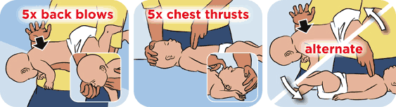 cha me phai biet: cach so cuu khi tre bi hoc di vat - 3