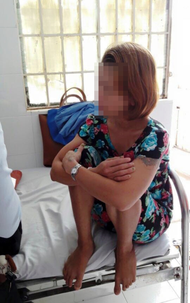  Bà X. cho rằng vết thương trên mặt cháu T. là do bị té 