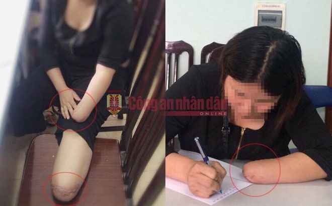 hai hung loi thu nhan thue chat chan tay de truc loi cua co gai tre hinh anh 1