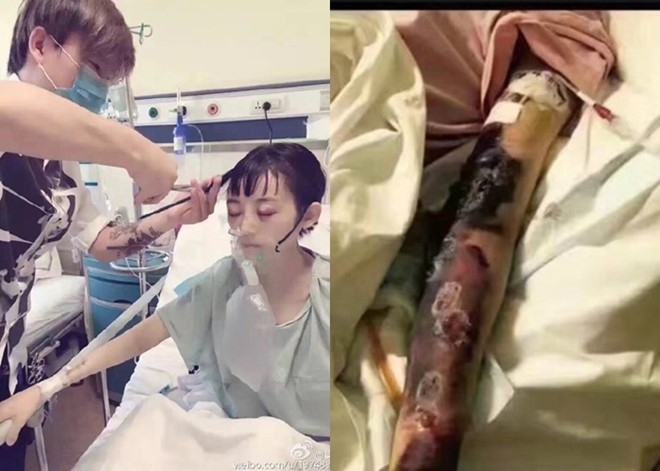 Sao nu 'Tay Thi bi su' qua doi o tuoi 24 vi ung thu hach hinh anh 2