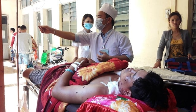 Hai thanh nien bi thuong nang khi cua bom hinh anh 1