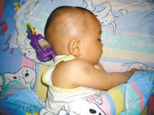 be 11 thang bi do choi cam vao nao, phan ung cua nguoi me khien bac si tam tac - 1
