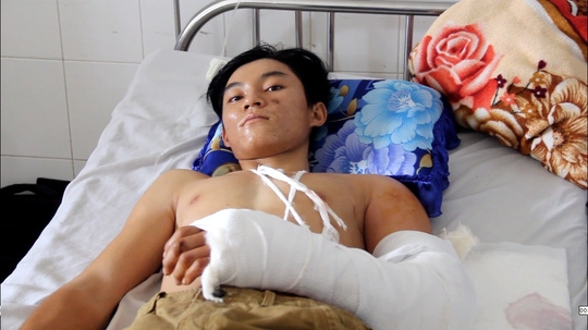  Anh Nhẫn đang điều trị tại Bệnh viện Đa khoa Trung ương Cần Thơ 