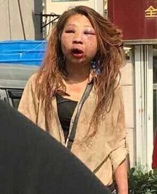 kinh hoang co gai bien dang mat may vi bi danh ghen hinh anh 1