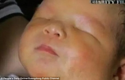 Bé trai kháu khỉnh mắc căn bệnh hiếm gặp khiến bé... không có mắt.