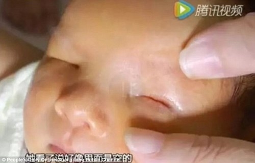 Mẹ đau đớn phát hiện con trai sinh ra không có mắt - ảnh 1