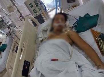 Co giao tre bi xe chen ngang nguoi duoc mo cuu con hinh anh 1