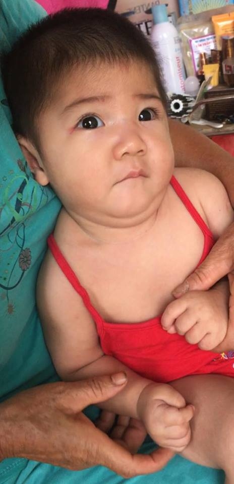 Sau hơn 3 tháng được mẹ nuôi chăm sóc, bé gái 14 tháng tuổi nặng 3,5kg giờ ra sao?