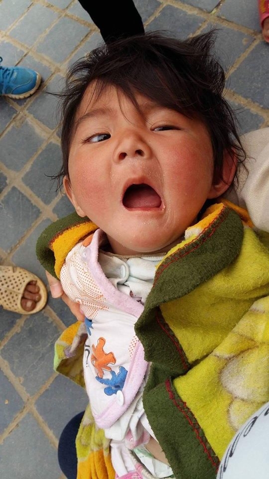 Sau hơn 3 tháng được mẹ nuôi chăm sóc, bé gái 14 tháng tuổi nặng 3,5kg giờ ra sao?