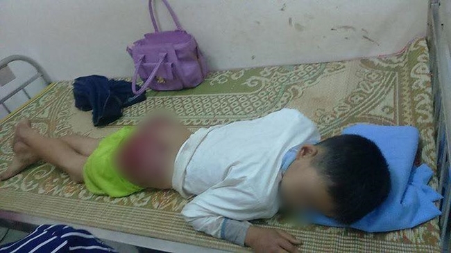 Hình ảnh gây phẫn nộ: Bé trai 13 tuổi bị cha ruột đánh tứa máu - Ảnh 2.