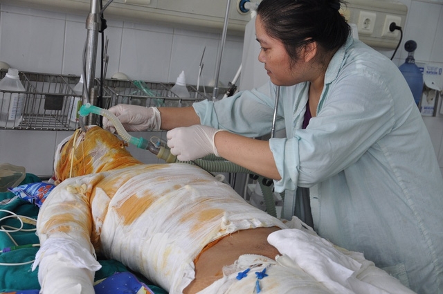 Chị Hùy bị bỏng 2 chân nhưng vẫn cố chăm con.