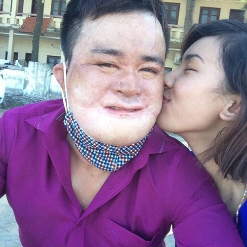 Chuyện tình cảm động của 'Hòa bỏng' và bạn đời xinh đẹp - ảnh 1