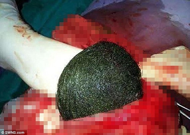 dau bung, di vien kham thay mo toc khong lo to bang qua dua hinh anh 2