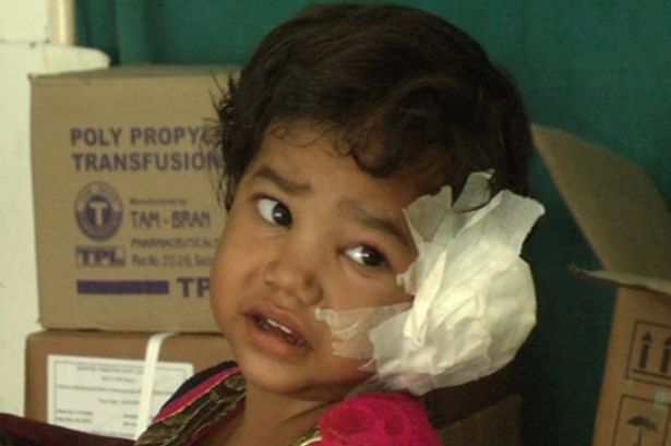  Radhika Mandloi thấy đau và ngứa tai trái từ một tuần trước. 
