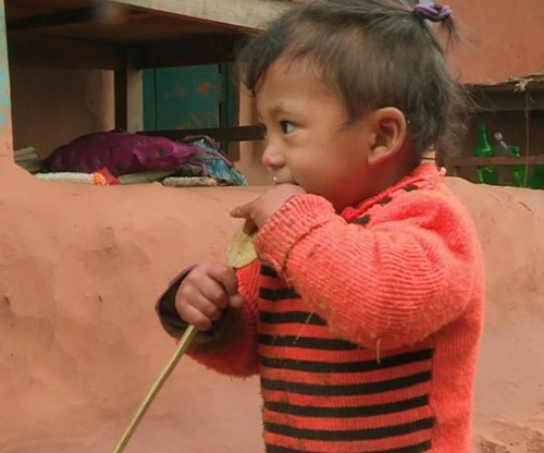 Bé trai Nepal 'mọc' thêm tay ở... lưng ảnh 1