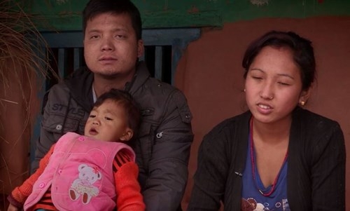 Bé trai Nepal 'mọc' thêm tay ở... lưng ảnh 3