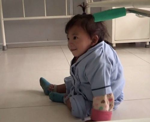 Bé trai Nepal 'mọc' thêm tay ở... lưng ảnh 8