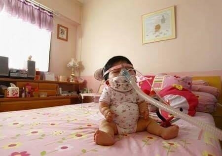 Cơ thể của em không thể phát triển một cách bình thường, cụ thể là chân tay của Pei Shan sẽ ngắn hơn so với chiều dài chuẩn. (Ảnh: QQ)