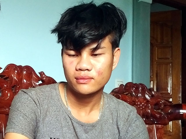 vu chem chet can bo bao ve rung: loi ke kinh hoang cua nhan chung hinh anh 2