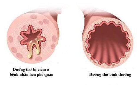 6-loi-khuyen-giup-phong-hen-phe-quan-khi-giao-mua