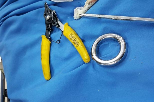 Kẹt “của quý” trong nhẫn, mất 3 giờ dùng cưa sắt giải cứu - 2