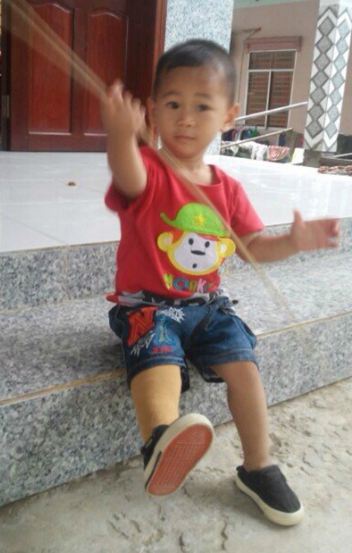 be-trai-vang-khoi-bung-me-chay-tren-chan-gia-o-tuoi-len-2-1