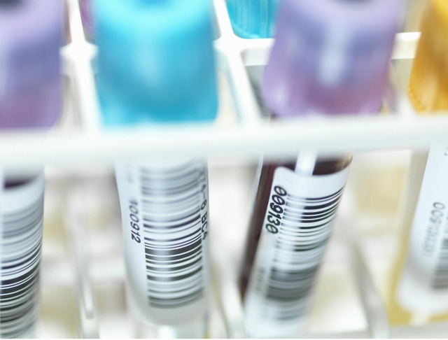 Người mang vi rút HIV hiện đang được điều trị bằng thuốc uống hàng ngày chỉ có tác dụng kìm hãm bệnh