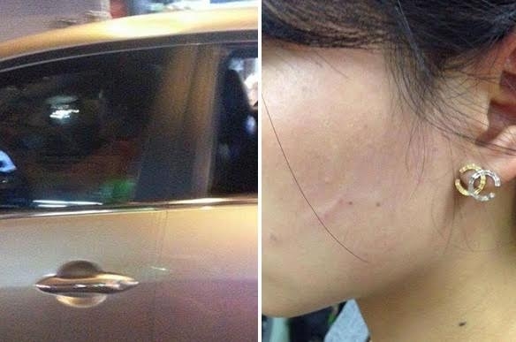 Đại gia dừng ô tô, tát vào mặt thiếu nữ?