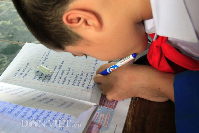 Rơi lệ chuyện cậu bé không tay, chân thấp chân cao bị bố mẹ bỏ rơi hình ảnh 7 roi le chuyen cau be khong tay, chan thap chan cao bi bo me bo roi hinh anh 7