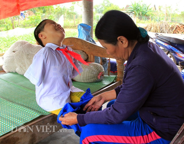 Rơi lệ chuyện cậu bé không tay, chân thấp chân cao bị bố mẹ bỏ rơi hình ảnh 12 roi le chuyen cau be khong tay, chan thap chan cao bi bo me bo roi hinh anh 12