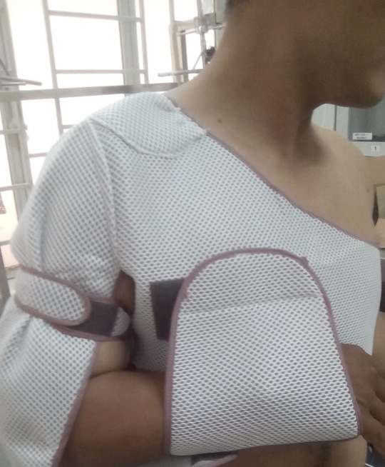 Hiệp sĩ L.N.P (32 tuổi) bị thương sau khi bị nhóm đối tượng tấn công