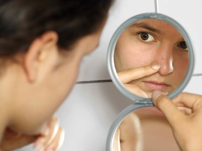 Bệnh nhân không nên tự nặn mụn hoặc nhờ người khác mà bàn tay chưa sát trùng, hoặc dùng những dụng cụ nặn mụn chưa được khử trùng cũng dễ gây nhiễm độc, nhiễm trùng. /// Ảnh minh họa: Shutterstock