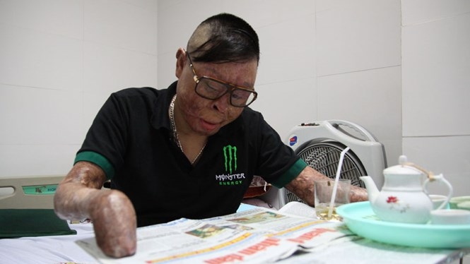 Thượng úy Đinh Văn Dương đọc báo trong lúc nằm viện tại Viện bỏng quốc gia Lê Hữu Trác /// Ảnh Phạm Dự