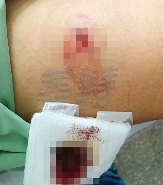 Cô gái bị bạn trai cũ giam cầm suốt 3 ngày, bắt uống nước xả vải, phun thuốc trừ sâu vào mặt - Ảnh 2.