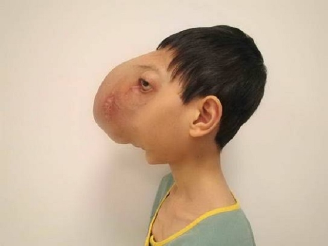 Thay đổi diệu kỳ của chàng trai Việt không có mặt qua 4 cuộc phẫu thuật của giáo sư Mỹ - Ảnh 2.