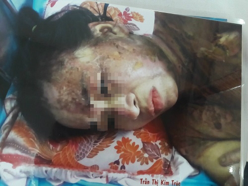 khong chiu moc cong tac, nguoi phu nu bi dong nghiep tat nguyen ca noi thit kho dang soi - 1