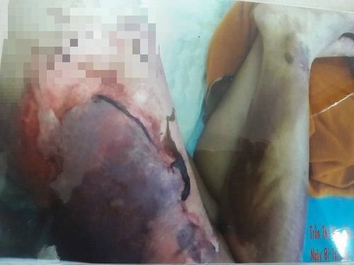 khong chiu moc cong tac, nguoi phu nu bi dong nghiep tat nguyen ca noi thit kho dang soi - 2