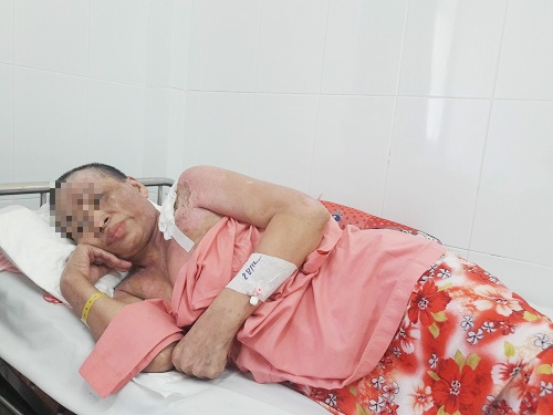 khong chiu moc cong tac, nguoi phu nu bi dong nghiep tat nguyen ca noi thit kho dang soi - 3