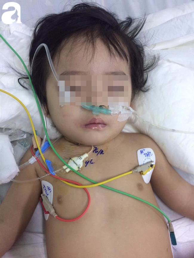 Bé gái 13 tháng tuổi chấn thương sọ não ở nhà trẻ tư, cô giáo xưng mẹ, từ chối nhập viện khiến bé nguy kịch? - Ảnh 4.