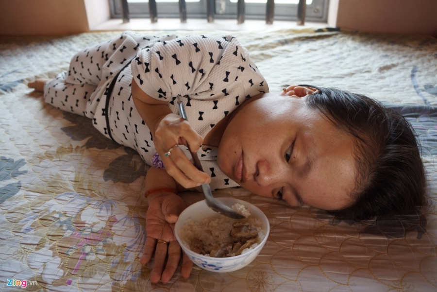 Nghi luc cua co gai cao 90 cm, nang 18 kg bi bai liet tu nho hinh anh 6