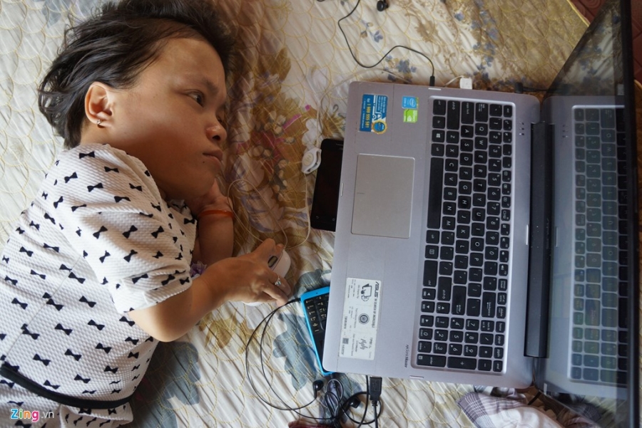 Nghi luc cua co gai cao 90 cm, nang 18 kg bi bai liet tu nho hinh anh 7