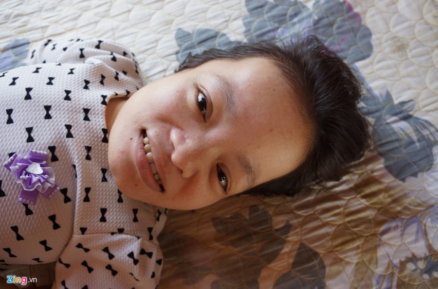 Nghi luc cua co gai cao 90 cm, nang 18 kg bi bai liet tu nho hinh anh 10