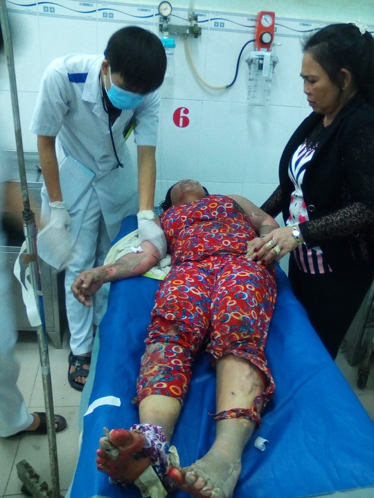  Bà Trinh lúc cấp cứu tại Bệnh viện Đa khoa Trà Vinh 