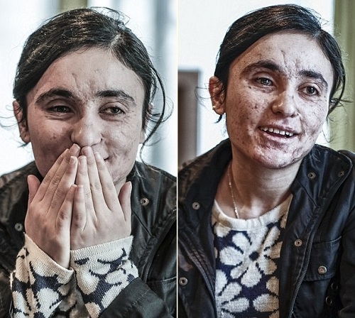 thieu-nu-yazidi-ke-chuyen-bi-nem-vao-phong-cho-40-ke-ham-hiep-1