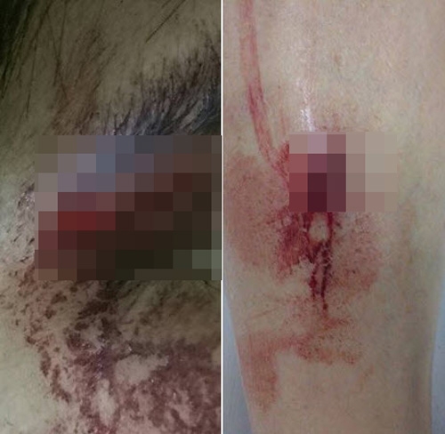 co gai bi danh chay mau dau vi thu do nhung khong mua o cho sinh vien - 1