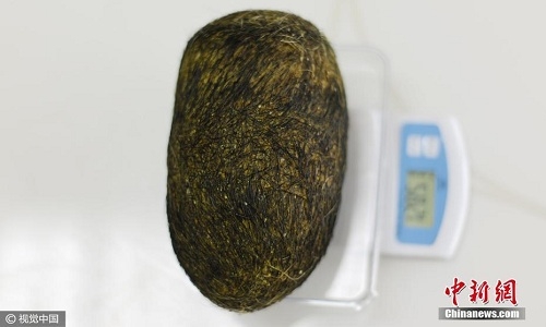 trung-la-trong-bung-lon-nghi-thuoc-quy-gia-trieu-usd-1