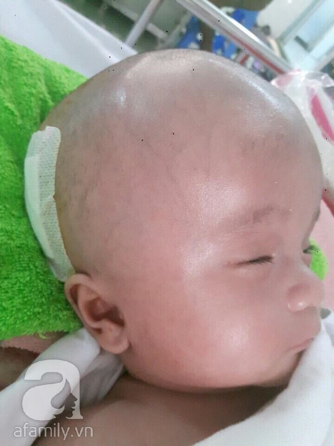 Lùm xùm vụ trục lợi tiền ủng hộ bé bị não úng thủy chữa trị tại Singapore, tình nguyện viên và sư thầy lên tiếng - Ảnh 3.