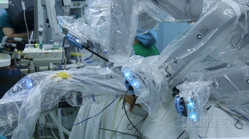 Khám phá ca mổ bằng robot tại Bệnh viện Bình dân TP.HCM - ảnh 11