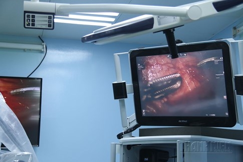 Khám phá ca mổ bằng robot tại Bệnh viện Bình dân TP.HCM - ảnh 12