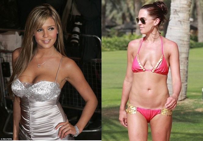 Khi thi Hoa hậu Anh năm 21 tuổi, Danielle Lloyd sở hữu ngực cỡ B nhưng sau đó liều lĩnh nâng lên cỡ D trong ca nâng ngực đầu tiên. Sự cố hỏng túi ngực khiến cô phải quay về cỡ AA và điều này khiến người đẹp rất tự ti /// Ảnh: Reuters/Twitter